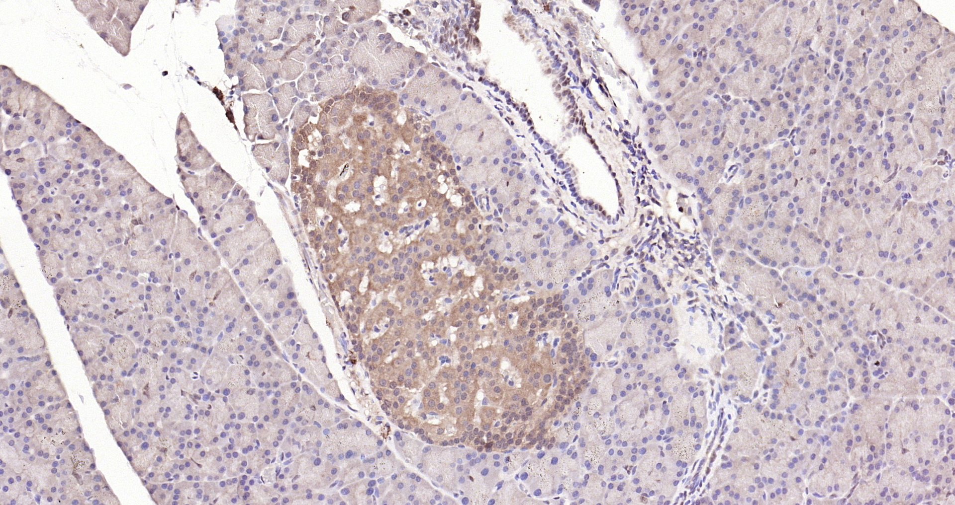 Paraformaldehyde-fixed, paraffin embedded Rat pancreas; Antigen retrieval by boiling in sodium citrate buffer (pH6.0) for 15min; Block endogenous peroxidase by 3% hydrogen peroxide for 20 minutes; Blocking buffer (normal goat serum) at 37°C for 30min; Antibody incubation with STAT3 (3F5) Monoclonal Antibody, Unconjugated (bsm-33218M) at 1:200 overnight at 4°C, DAB staining.