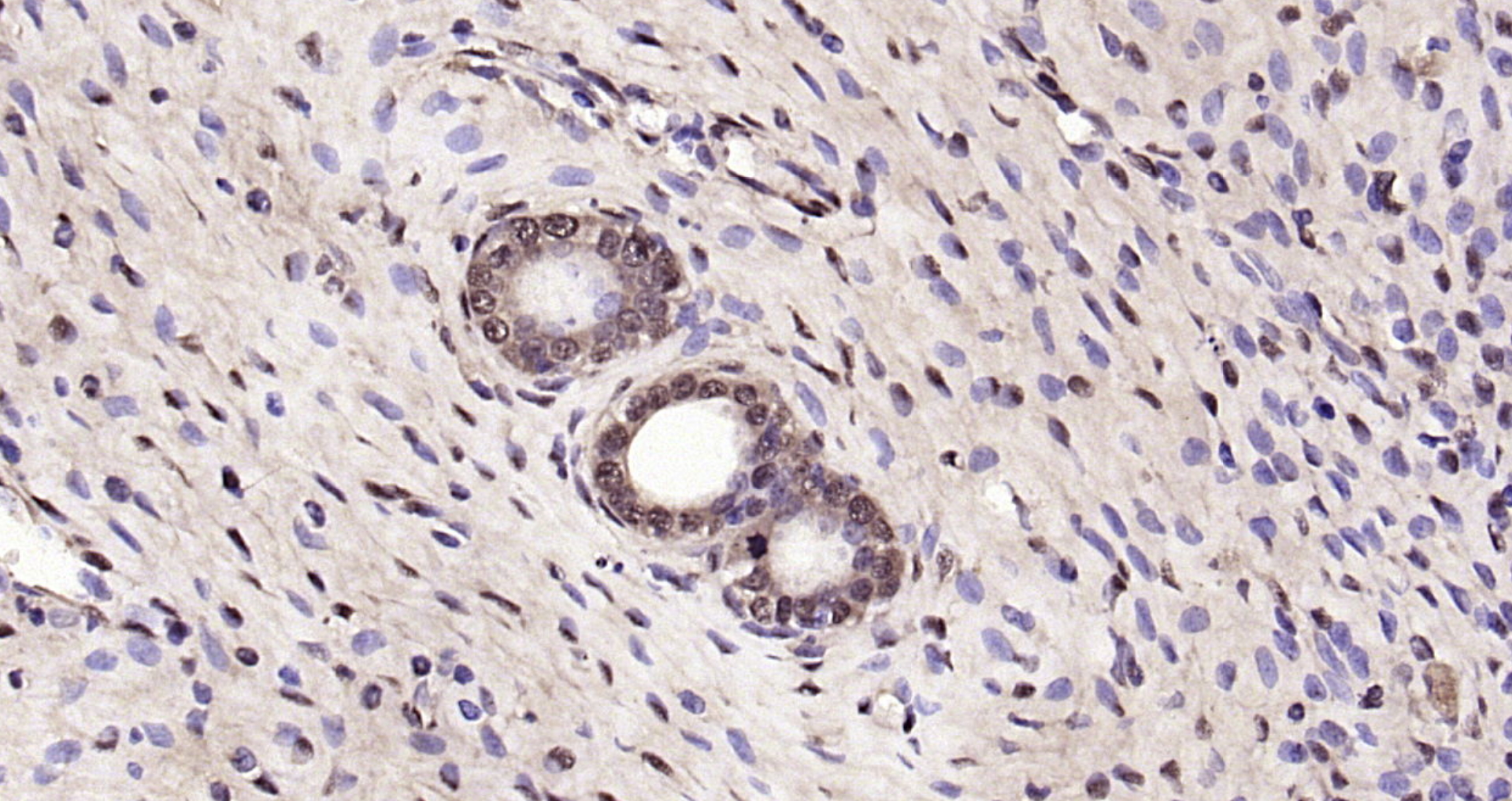 Paraformaldehyde-fixed, paraffin embedded Mouse uterus; Antigen retrieval by boiling in sodium citrate buffer (pH6.0) for 15min; Block endogenous peroxidase by 3% hydrogen peroxide for 20 minutes; Blocking buffer (normal goat serum) at 37°C for 30min; Antibody incubation with DUSP3 Polyclonal Antibody, Unconjugated (bs-6246R) at 1:200 overnight at 4°C, DAB staining.