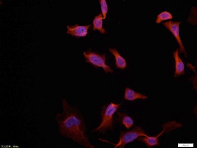 Tissue/cell: Hela cell; 4% Paraformaldehyde-fixed; Triton X-100 at room temperature for 20 min; Blocking buffer (normal goat serum, C-0005) at 37°C for 20 min; Antibody incubation with (MAKT1) polyclonal Antibody, Unconjugated (bs-0115M) 1:100, 90 minutes at 37°C; followed by a conjugated Goat Anti-Mouse IgG-CY3 antibody at 37°C for 90 minutes, DAPI (blue) was used to stain the cell nuclei.