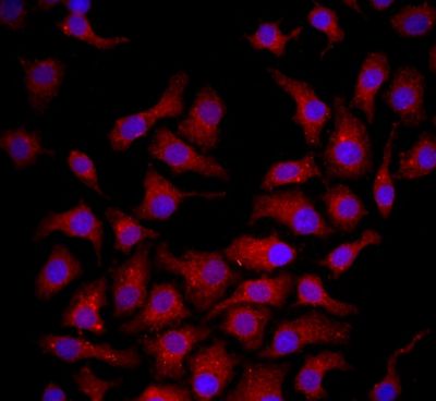 Tissue\/cell: HepG2 cell; 4% Paraformaldehyde-fixed; Triton X-100 at room temperature for 20 min; Blocking buffer (normal goat serum, C-0005) at 37\u00b0C for 20 min; Antibody incubation with (NGF Receptor) polyclonal Antibody, Unconjugated (bs-0161R) 1:100, 90 minutes at 37\u00b0C; followed by a FITC conjugated Goat Anti-Rabbit IgG antibody at 37\u00b0C for 90 minutes, DAPI (blue) was used to stain the cell nuclei