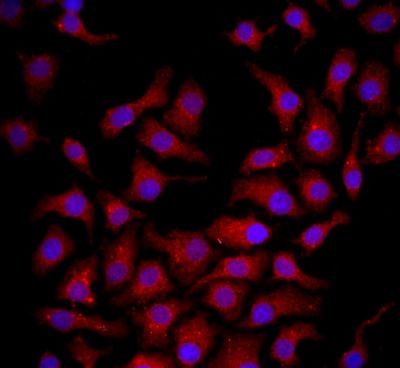 Tissue/cell: HepG2 cell; 4% Paraformaldehyde-fixed; Triton X-100 at room temperature for 20 min; Blocking buffer (normal goat serum, C-0005) at 37°C for 20 min; Antibody incubation with (NGF Receptor) polyclonal Antibody, Unconjugated (bs-0161R) 1:100, 90 minutes at 37°C; followed by a FITC conjugated Goat Anti-Rabbit IgG antibody at 37°C for 90 minutes, DAPI (blue) was used to stain the cell nuclei