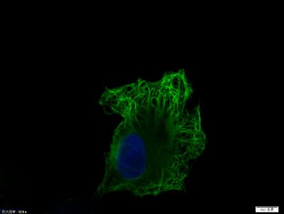 Tissue/cell: HepG2 cell; 4% Paraformaldehyde-fixed; Triton X-100 at room temperature for 20 min; Blocking buffer (normal goat serum, C-0005) at 37°C for 20 min; Antibody incubation with (Vimentin) Polyclonal Antibody, Unconjugated (bs-0756R) 1:50, 90 minutes at 37°C; followed by a conjugated Goat Anti-Rabbit IgG antibody (bs-0295G-FITC) at 37°C for 90 minutes, DAPI (blue, C02-04002) was used to stain the cell nuclei.