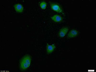 Tissue\/cell: Hela cell; 4% Paraformaldehyde-fixed; Triton X-100 at room temperature for 20 min; Blocking buffer (normal goat serum, C-0005) at 37\u00b0C for 20 min; Antibody incubation with (Bcl-2) polyclonal Antibody, Unconjugated (bs-0032R) 1:100, 90 minutes at 37\u00b0C; followed by a FITC conjugated Goat Anti-Rabbit IgG antibody at 37\u00b0C for 90 minutes, DAPI (blue, C02-04002) was used to stain the cell nuclei.