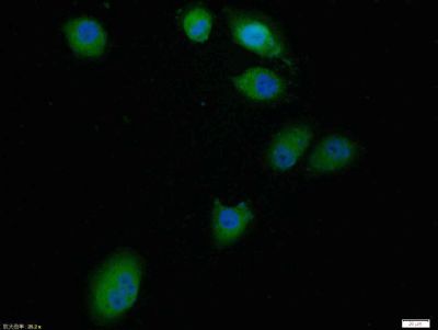 Tissue/cell: Hela cell; 4% Paraformaldehyde-fixed; Triton X-100 at room temperature for 20 min; Blocking buffer (normal goat serum, C-0005) at 37°C for 20 min; Antibody incubation with (Bcl-2) polyclonal Antibody, Unconjugated (bs-0032R) 1:100, 90 minutes at 37°C; followed by a FITC conjugated Goat Anti-Rabbit IgG antibody at 37°C for 90 minutes, DAPI (blue, C02-04002) was used to stain the cell nuclei.