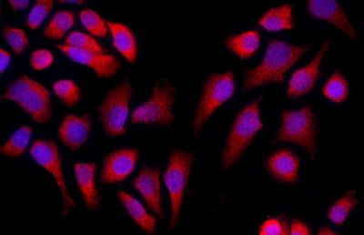 Tissue/cell: MCF-7 cell; 4% Paraformaldehyde-fixed; Triton X-100 at room temperature for 20 min; Blocking buffer (normal goat serum, C-0005) at 37°C for 20 min; Antibody incubation with (Caspase-9) Polyclonal Antibody, Unconjugated (bs-0049R) 1:50, 90 minutes at 37°C; followed by a conjugated Goat Anti-Rabbit IgG antibody (bs-0295G-Cy3) at 37°C for 90 minutes, DAPI (blue, C02-04002) was used to stain the cell nuclei