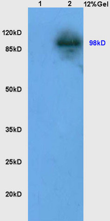 L1 mouse kidney lysates L2 mouse intestine lysates probed with Anti LONP1 Polyclonal Antibody, Unconjugated (bs-4245R) at 1:200 in 4˚C. Followed by conjugation to secondary antibody (bs-0295G-HRP) at 1:3000 90min in 37˚C. Predicted band 98kD. Observed band size: 98kD