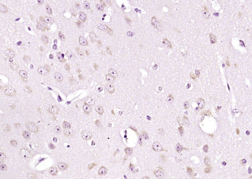 Paraformaldehyde-fixed, paraffin embedded Mouse brain; Antigen retrieval by boiling in sodium citrate buffer (pH6.0) for 15min; Block endogenous peroxidase by 3% hydrogen peroxide for 20 minutes; Blocking buffer (normal goat serum) at 37°C for 30min; Antibody incubation with SPOCK2/Testican 2 Polyclonal Antibody, Unconjugated (bs-11966R) at 1:200 overnight at 4°C, DAB staining. Paraformaldehyde-fixed, paraffin embedded Mouse brain; Antigen retrieval by boiling in sodium citrate buffer (pH6.0) for 15min; Block endogenous peroxidase by 3% hydrogen peroxide for 20 minutes; Blocking buffer (normal goat serum) at 37°C for 30min; Antibody incubation with SPOCK2/Testican 2 Polyclonal Antibody, Unconjugated (bs-11966R) at 1:200 overnight at 4°C, DAB staining.