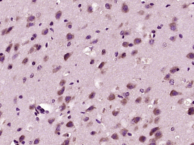 Paraformaldehyde-fixed, paraffin embedded Mouse brain; Antigen retrieval by boiling in sodium citrate buffer (pH6.0) for 15min; Block endogenous peroxidase by 3% hydrogen peroxide for 20 minutes; Blocking buffer (normal goat serum) at 37°C for 30min; Antibody incubation with alpha2 Adaptin Polyclonal Antibody, Unconjugated (bs-1228R) at 1:400 overnight at 4°C, DAB staining.