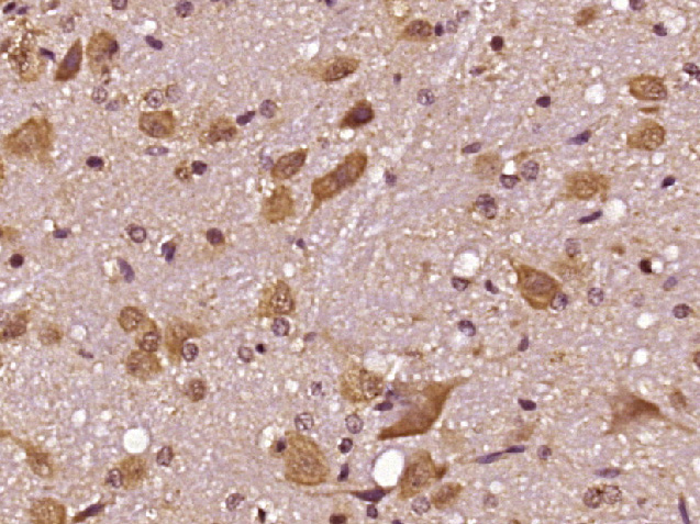 Paraformaldehyde-fixed, paraffin embedded Rat brain; Antigen retrieval by boiling in sodium citrate buffer (pH6.0) for 15min; Block endogenous peroxidase by 3% hydrogen peroxide for 20 minutes; Blocking buffer (normal goat serum) at 37°C for 30min; Antibody incubation with CPA3/MC-CPA Polyclonal Antibody, Unconjugated (bs-12338R) at 1:400 overnight at 4°C, DAB staining.