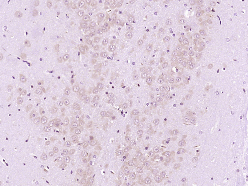 Paraformaldehyde-fixed, paraffin embedded Rat brain; Antigen retrieval by boiling in sodium citrate buffer (pH6.0) for 15min; Block endogenous peroxidase by 3% hydrogen peroxide for 20 minutes; Blocking buffer (normal goat serum) at 37°C for 30min; Antibody incubation with WISP3 Polyclonal Antibody, Unconjugated (bs-12380R) at 1:400 overnight at 4°C, DAB staining.