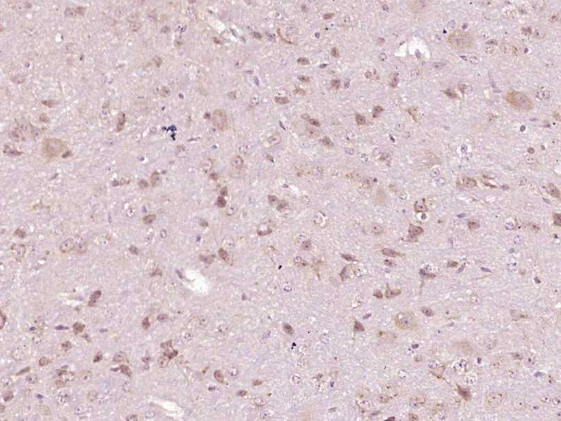 Paraformaldehyde-fixed, paraffin embedded Mouse cerebellum; Antigen retrieval by boiling in sodium citrate buffer (pH6.0) for 15min; Block endogenous peroxidase by 3% hydrogen peroxide for 20 minutes; Blocking buffer (normal goat serum) at 37°C for 30min; Antibody incubation with FAM134B Polyclonal Antibody, Unconjugated (bs-13136R) at 1:400 overnight at 4°C, DAB staining.