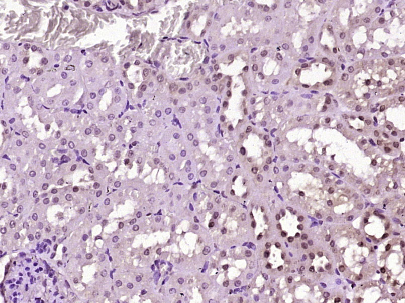 Paraformaldehyde-fixed, paraffin embedded Rat kidney; Antigen retrieval by boiling in sodium citrate buffer (pH6.0) for 15min; Block endogenous peroxidase by 3% hydrogen peroxide for 20 minutes; Blocking buffer (normal goat serum) at 37°C for 30min; Antibody incubation with GABPA/NRF2A Polyclonal Antibody, Unconjugated (bs-13261R) at 1:400 overnight at 4°C, DAB staining.
