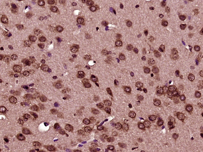 Paraformaldehyde-fixed, paraffin embedded Mouse brain; Antigen retrieval by boiling in sodium citrate buffer (pH6.0) for 15min; Block endogenous peroxidase by 3% hydrogen peroxide for 20 minutes; Blocking buffer (normal goat serum) at 37°C for 30min; Antibody incubation with BCL2L1 Polyclonal Antibody, Unconjugated (bs-1336R) at 1:400 overnight at 4°C, DAB staining.