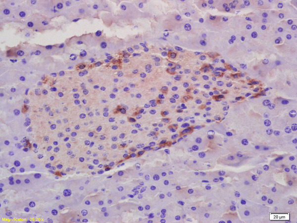 Formalin-fixed and paraffin embedded rat placenta labeled with Rabbit Anti phospho-ZCWCC1 (Ser739) Polyclonal Antibody, Unconjugated (bs-10016R) at 1:200 followed by conjugation to the secondary antibody and DAB staining