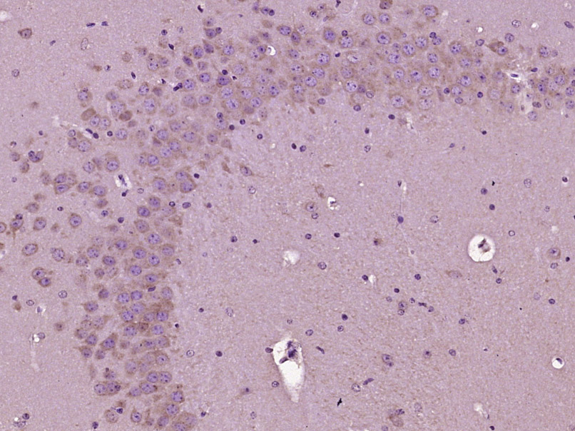 Paraformaldehyde-fixed, paraffin embedded Mouse brain; Antigen retrieval by boiling in sodium citrate buffer (pH6.0) for 15min; Block endogenous peroxidase by 3% hydrogen peroxide for 20 minutes; Blocking buffer (normal goat serum) at 37°C for 30min; Antibody incubation with MAP2/MAP-2a.b.c Polyclonal Antibody, Unconjugated (bs-1369R) at 1:400 overnight at 4°C, DAB staining.