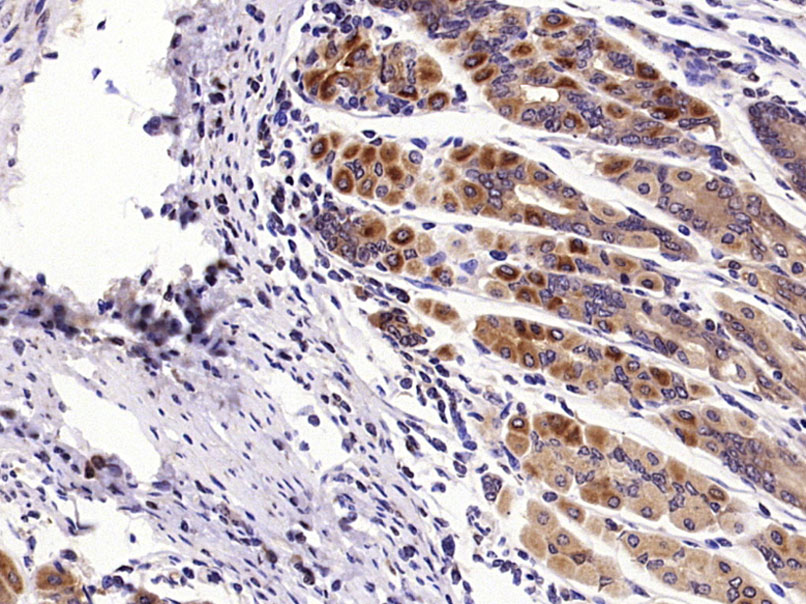 Paraformaldehyde-fixed, paraffin embedded Mouse stomach; Antigen retrieval by boiling in sodium citrate buffer (pH6.0) for 15min; Block endogenous peroxidase by 3% hydrogen peroxide for 20 minutes; Blocking buffer (normal goat serum) at 37°C for 30min; Antibody incubation with Shh Polyclonal Antibody, Unconjugated (bs-1544R) at 1:400 overnight at 4°C, DAB staining.