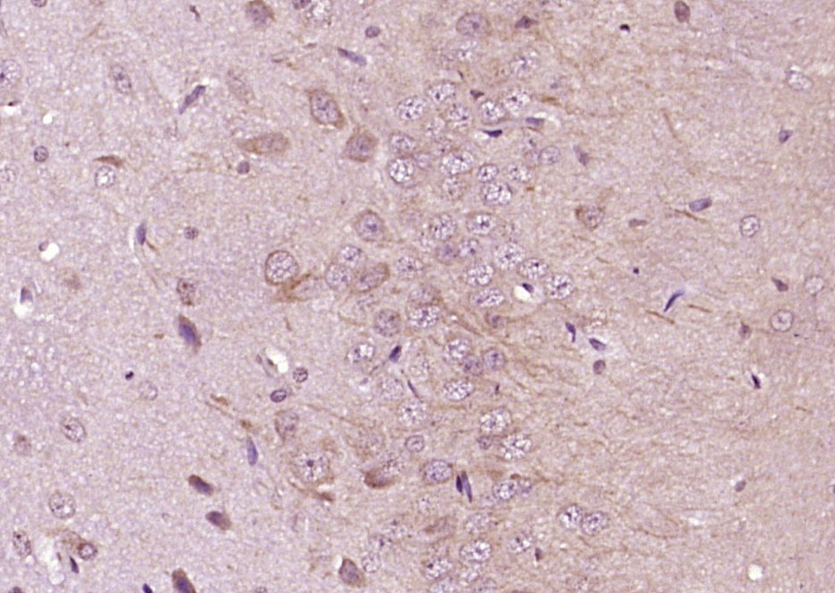 Paraformaldehyde-fixed, paraffin embedded Rat brain; Antigen retrieval by boiling in sodium citrate buffer (pH6.0) for 15min; Block endogenous peroxidase by 3% hydrogen peroxide for 20 minutes; Blocking buffer (normal goat serum) at 37°C for 30min; Antibody incubation with Alpha-Catenin/CTNNA1 Polyclonal Antibody, Unconjugated (bs-1594R) at 1:400 overnight at 4°C, DAB staining.