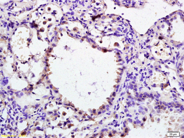Formalin-fixed and paraffin embedded rat lung labeled with Anti-phospho-DAXX (Ser495) Polyclonal Antibody, Unconjugated (bs-5291R) at 1:200 followed by conjugation to the secondary antibody