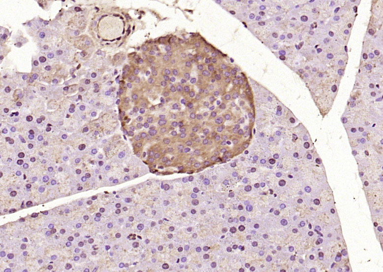 Paraformaldehyde-fixed, paraffin embedded Mouse pancreas; Antigen retrieval by boiling in sodium citrate buffer (pH6.0) for 15min; Block endogenous peroxidase by 3% hydrogen peroxide for 20 minutes; Blocking buffer (normal goat serum) at 37°C for 30min; Antibody incubation with ATF6 Polyclonal Antibody, Unconjugated (bs-1634R) at 1:200 overnight at 4°C, DAB staining.