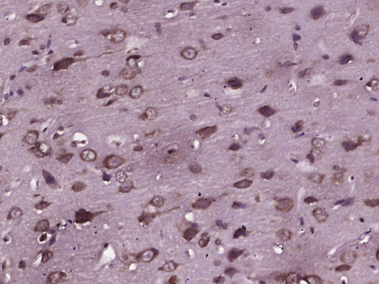 Paraformaldehyde-fixed, paraffin embedded Rat brain; Antigen retrieval by boiling in sodium citrate buffer (pH6.0) for 15min; Block endogenous peroxidase by 3% hydrogen peroxide for 20 minutes; Blocking buffer (normal goat serum) at 37°C for 30min; Antibody incubation with JNK1+2+3 (T183+Y185) Polyclonal Antibody, Unconjugated (bs-1640R) at 1:400 overnight at 4°C, DAB staining.