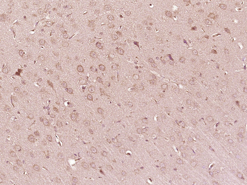 Paraformaldehyde-fixed, paraffin embedded Rat brain; Antigen retrieval by boiling in sodium citrate buffer (pH6.0) for 15min; Block endogenous peroxidase by 3% hydrogen peroxide for 20 minutes; Blocking buffer (normal goat serum) at 37°C for 30min; Antibody incubation with ATP7B Polyclonal Antibody, Unconjugated (bs-1718R) at 1:400 overnight at 4°C, DAB staining.