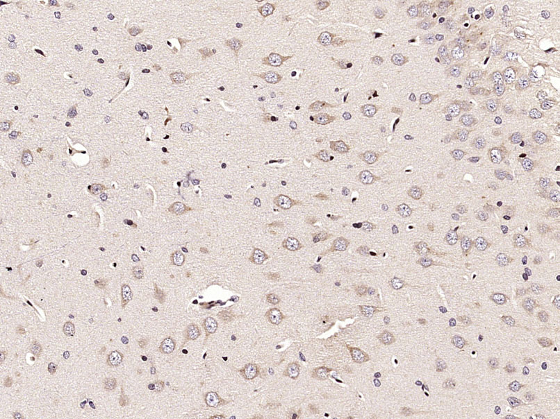 Paraformaldehyde-fixed, paraffin embedded Rat brain; Antigen retrieval by boiling in sodium citrate buffer (pH6.0) for 15min; Block endogenous peroxidase by 3% hydrogen peroxide for 20 minutes; Blocking buffer (normal goat serum) at 37°C for 30min; Antibody incubation with ECE2 Polyclonal Antibody, Unconjugated (bs-1753R) at 1:400 overnight at 4°C, DAB staining.