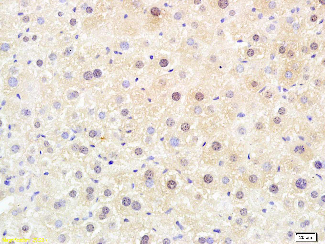 Paraformaldehyde-fixed, paraffin embedded Mouse liver; Antigen retrieval by boiling in sodium citrate buffer (pH6.0) for 15min; Block endogenous peroxidase by 3% hydrogen peroxide for 20 minutes; Blocking buffer (normal goat serum) at 37°C for 30min; Antibody incubation with PGC1 alpha Polyclonal Antibody, Unconjugated (bs-1832R) at 1:200 overnight at 4°C, DAB staining.