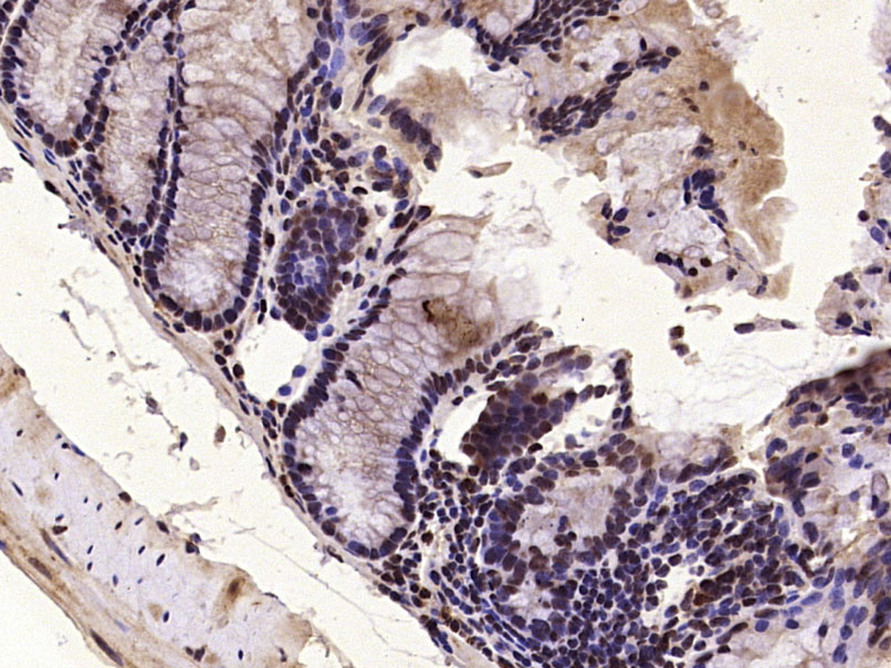 Paraformaldehyde-fixed, paraffin embedded Mouse colon; Antigen retrieval by boiling in sodium citrate buffer (pH6.0) for 15min; Block endogenous peroxidase by 3% hydrogen peroxide for 20 minutes; Blocking buffer (normal goat serum) at 37°C for 30min; Antibody incubation with DUSP1/MKP1 Polyclonal Antibody, Unconjugated (bs-1851R) at 1:400 overnight at 4°C, DAB staining.