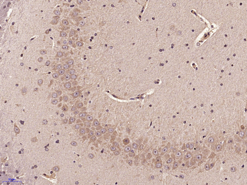 Paraformaldehyde-fixed, paraffin embedded Rat brain; Antigen retrieval by boiling in sodium citrate buffer (pH6.0) for 15min; Block endogenous peroxidase by 3% hydrogen peroxide for 20 minutes; Blocking buffer (normal goat serum) at 37°C for 30min; Antibody incubation with Socs 2 Polyclonal Antibody, Unconjugated (bs-1896R) at 1:400 overnight at 4°C, DAB staining.