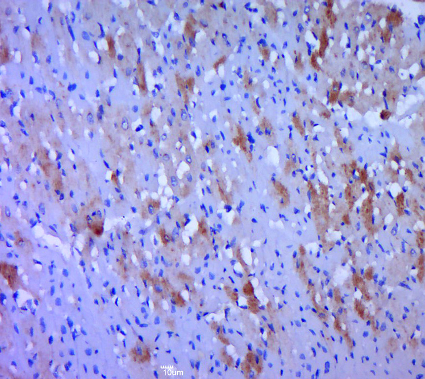 Paraformaldehyde-fixed, paraffin embedded Rat heart; Antigen retrieval by boiling in sodium citrate buffer (pH6.0) for 15min; Block endogenous peroxidase by 3% hydrogen peroxide for 20 minutes; Blocking buffer (normal goat serum) at 37°C for 30min; Antibody incubation with WNT2B Polyclonal Antibody, Unconjugated (bs-1946R) at 1:400 overnight at 4°C, DAB staining.