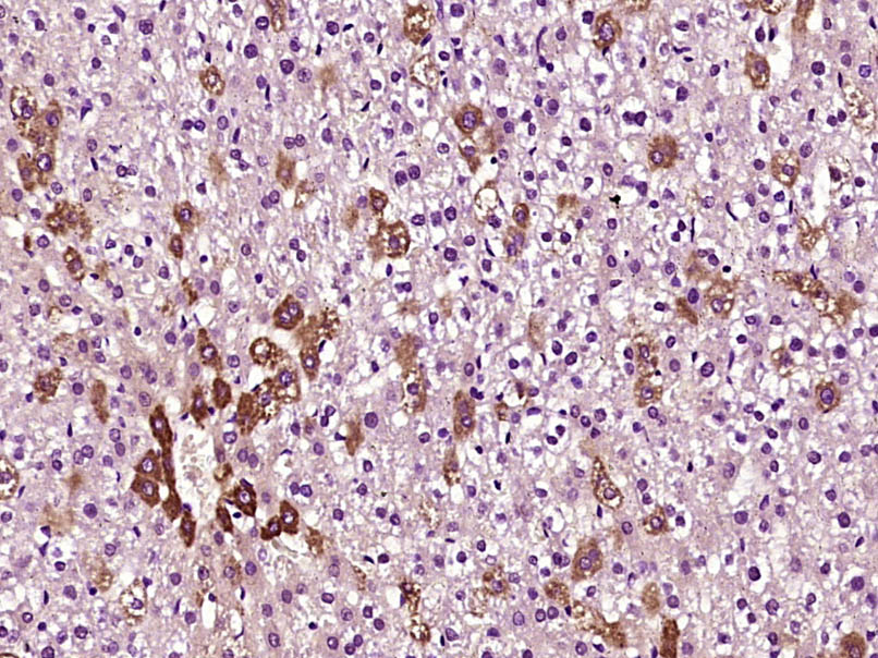 Paraformaldehyde-fixed, paraffin embedded Rat liver; Antigen retrieval by boiling in sodium citrate buffer (pH6.0) for 15min; Block endogenous peroxidase by 3% hydrogen peroxide for 20 minutes; Blocking buffer (normal goat serum) at 37°C for 30min; Antibody incubation with LPL Polyclonal Antibody, Unconjugated (bs-1973R) at 1:400 overnight at 4°C, DAB staining.
