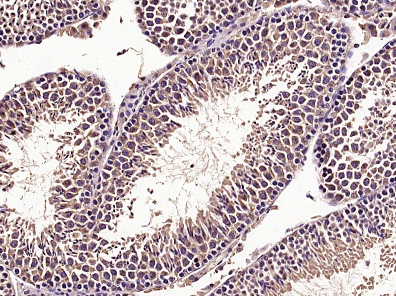 Paraformaldehyde-fixed, paraffin embedded Mouse testis; Antigen retrieval by boiling in sodium citrate buffer (pH6.0) for 15min; Block endogenous peroxidase by 3% hydrogen peroxide for 20 minutes; Blocking buffer (normal goat serum) at 37°C for 30min; Antibody incubation with mTOR/FRAP Polyclonal Antibody, Unconjugated (bs-1992R) at 1:400 overnight at 4°C, DAB staining.