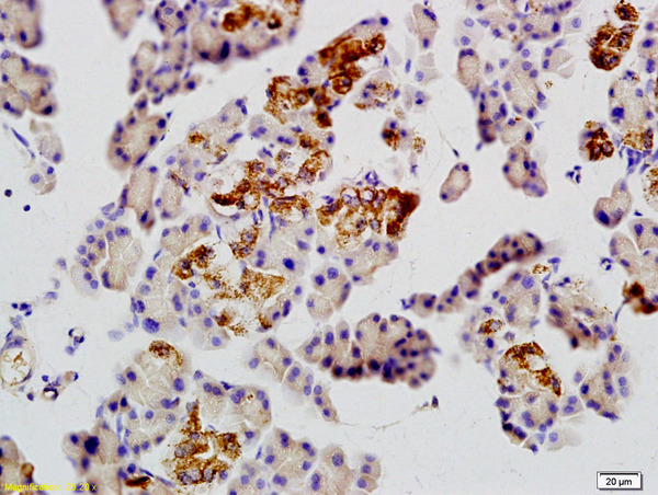 Formalin-fixed and paraffin embedded rat pancreas tissue labeled with Anti-GLUT10/Glucose Transporter GLUT10 Polyclonal Antibody, Unconjugated (bs-6325R) at 1:200 followed by conjugation to the secondary antibody
