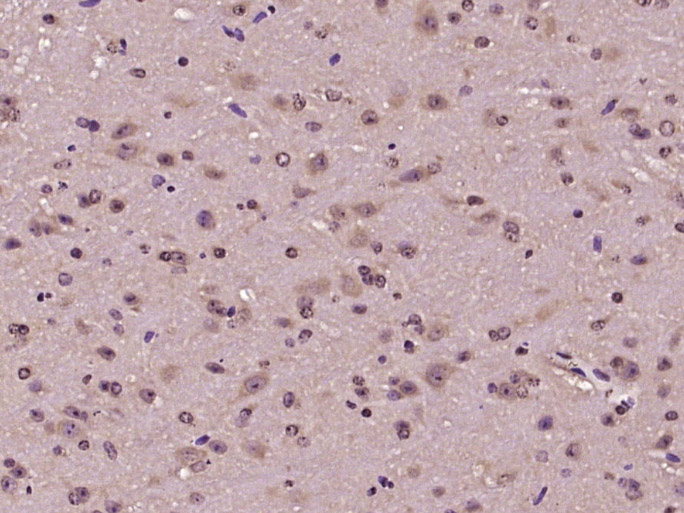 Paraformaldehyde-fixed, paraffin embedded Mouse brain; Antigen retrieval by boiling in sodium citrate buffer (pH6.0) for 15min; Block endogenous peroxidase by 3% hydrogen peroxide for 20 minutes; Blocking buffer (normal goat serum) at 37°C for 30min; Antibody incubation with GTSE-1 Polyclonal Antibody, Unconjugated (bs-2516R) at 1:400 overnight at 4°C, DAB staining.