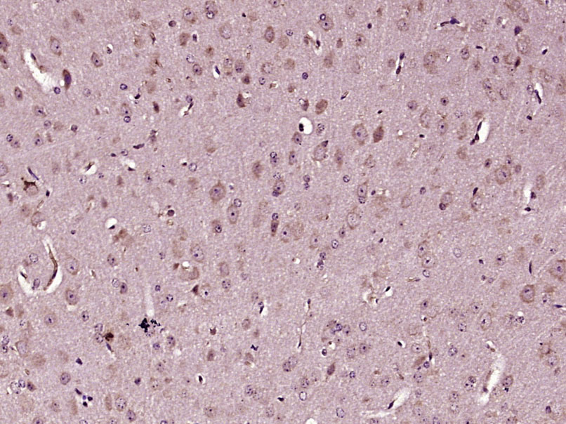 Paraformaldehyde-fixed, paraffin embedded Mouse brain; Antigen retrieval by boiling in sodium citrate buffer (pH6.0) for 15min; Block endogenous peroxidase by 3% hydrogen peroxide for 20 minutes; Blocking buffer (normal goat serum) at 37°C for 30min; Antibody incubation with Caspase 3 Polyclonal Antibody, Unconjugated (bs-2593R) at 1:400 overnight at 4°C, DAB staining.