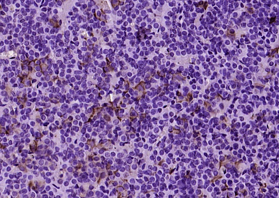 Paraformaldehyde-fixed, paraffin embedded Mouse hypophysis; Antigen retrieval by boiling in sodium citrate buffer (pH6.0) for 15min; Block endogenous peroxidase by 3% hydrogen peroxide for 20 minutes; Blocking buffer (normal goat serum) at 37°C for 30min; Antibody incubation with _x000D_ TSH Polyclonal Antibody, Unconjugated (bs-2676R) at 1:200 overnight at 4°C, DAB staining.