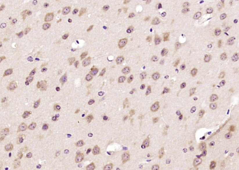 Paraformaldehyde-fixed, paraffin embedded Mouse brain; Antigen retrieval by boiling in sodium citrate buffer (pH6.0) for 15min; Block endogenous peroxidase by 3% hydrogen peroxide for 20 minutes; Blocking buffer (normal goat serum) at 37°C for 30min; Antibody incubation with Bcr Polyclonal Antibody, Unconjugated (bs-2747R) at 1:200 overnight at 4°C, DAB staining.