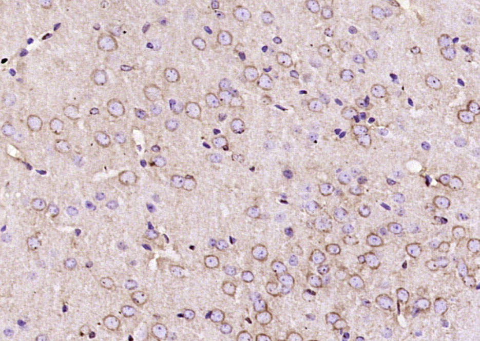 Paraformaldehyde-fixed, paraffin embedded Mouse brain; Antigen retrieval by boiling in sodium citrate buffer (pH6.0) for 15min; Block endogenous peroxidase by 3% hydrogen peroxide for 20 minutes; Blocking buffer (normal goat serum) at 37°C for 30min; Antibody incubation with CACNA1G Polyclonal Antibody, Unconjugated (bs-2781R) at 1:200 overnight at 4°C, DAB staining.