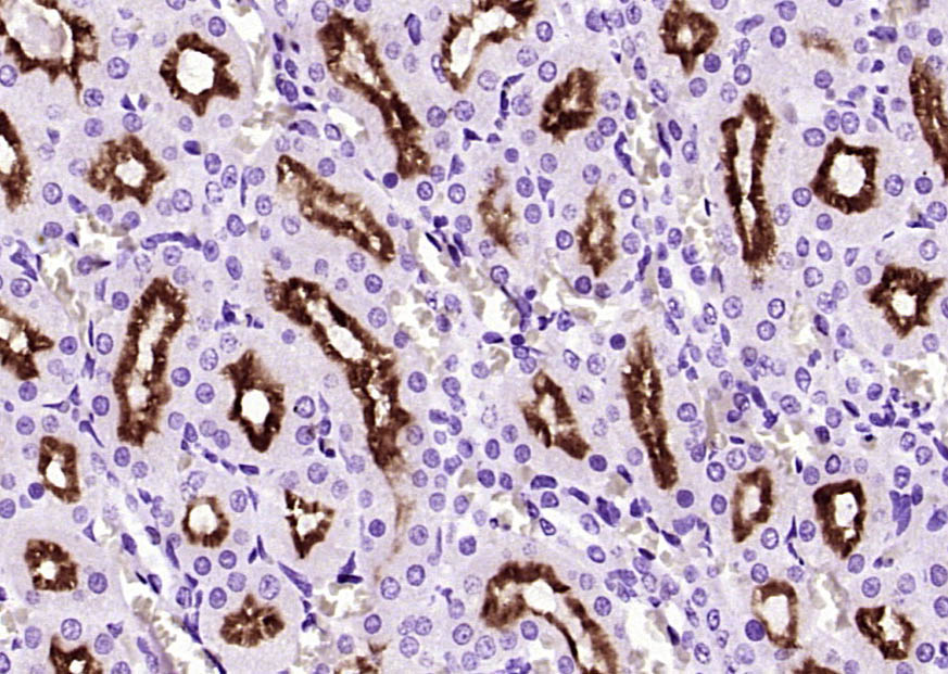 Paraformaldehyde-fixed, paraffin embedded Mouse kidney; Antigen retrieval by boiling in sodium citrate buffer (pH6.0) for 15min; Block endogenous peroxidase by 3% hydrogen peroxide for 20 minutes; Blocking buffer (normal goat serum) at 37°C for 30min; Antibody incubation with Klotho Polyclonal Antibody, Unconjugated (bs-2925R) at 1:400 overnight at 4°C, DAB staining.