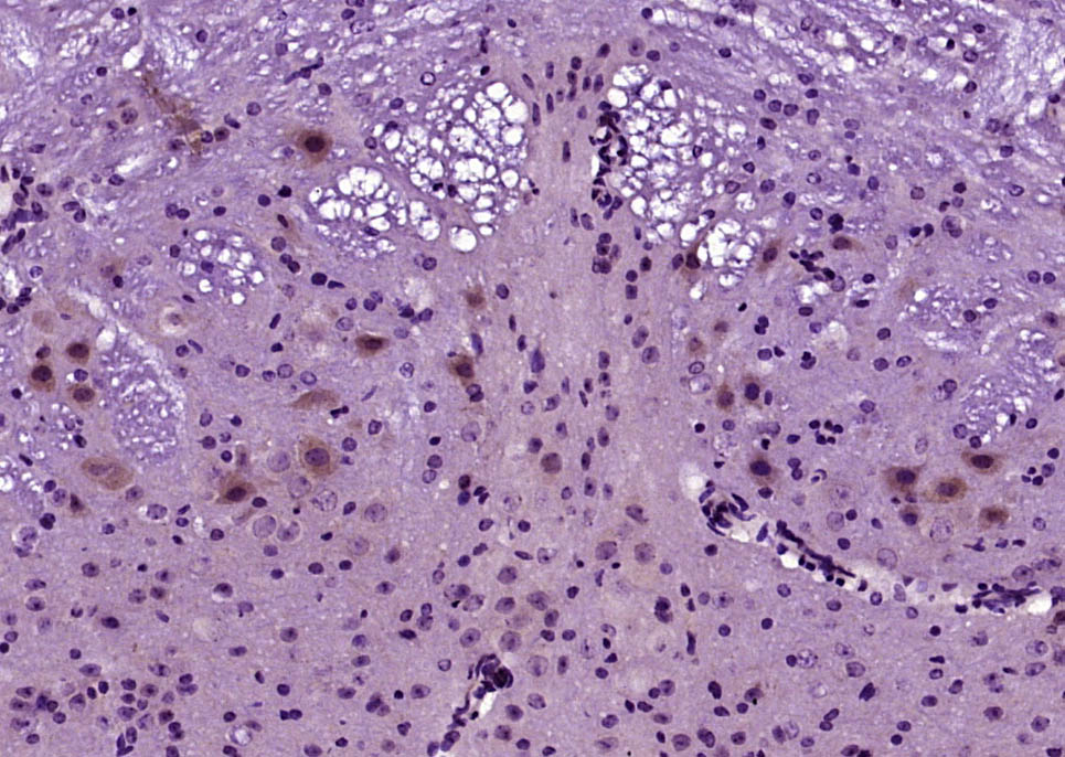 Paraformaldehyde-fixed, paraffin embedded Mouse brain; Antigen retrieval by boiling in sodium citrate buffer (pH6.0) for 15min; Block endogenous peroxidase by 3% hydrogen peroxide for 20 minutes; Blocking buffer (normal goat serum) at 37°C for 30min; Antibody incubation with Klotho Polyclonal Antibody, Unconjugated (bs-2925R) at 1:400 overnight at 4°C, DAB staining.
