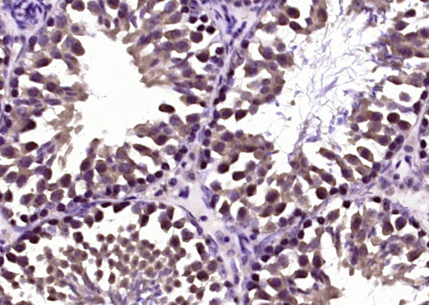 Paraformaldehyde-fixed, paraffin embedded Mouse testis; Antigen retrieval by boiling in sodium citrate buffer (pH6.0) for 15min; Block endogenous peroxidase by 3% hydrogen peroxide for 20 minutes; Blocking buffer (normal goat serum) at 37°C for 30min; Antibody incubation with Klotho Polyclonal Antibody, Unconjugated (bs-2925R) at 1:400 overnight at 4°C, DAB staining.