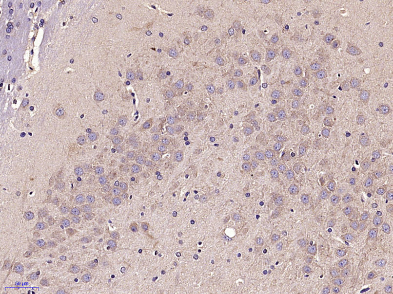 Paraformaldehyde-fixed, paraffin embedded Rat brain; Antigen retrieval by boiling in sodium citrate buffer (pH6.0) for 15min; Block endogenous peroxidase by 3% hydrogen peroxide for 20 minutes; Blocking buffer (normal goat serum) at 37°C for 30min; Antibody incubation with ADM2 Polyclonal Antibody, Unconjugated (bs-2985R) at 1:400 overnight at 4°C, DAB staining.