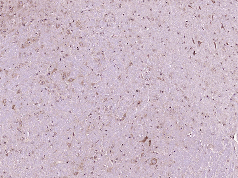 Paraformaldehyde-fixed, paraffin embedded Mouse brain; Antigen retrieval by boiling in sodium citrate buffer (pH6.0) for 15min; Block endogenous peroxidase by 3% hydrogen peroxide for 20 minutes; Blocking buffer (normal goat serum) at 37\u00b0C for 30min; Antibody incubation with ADM2 Polyclonal Antibody, Unconjugated (bs-2985R) at 1:400 overnight at 4\u00b0C, DAB staining.