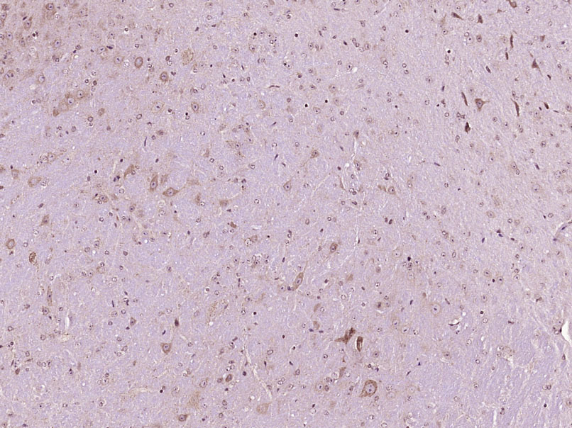 Paraformaldehyde-fixed, paraffin embedded Mouse brain; Antigen retrieval by boiling in sodium citrate buffer (pH6.0) for 15min; Block endogenous peroxidase by 3% hydrogen peroxide for 20 minutes; Blocking buffer (normal goat serum) at 37°C for 30min; Antibody incubation with ADM2 Polyclonal Antibody, Unconjugated (bs-2985R) at 1:400 overnight at 4°C, DAB staining.