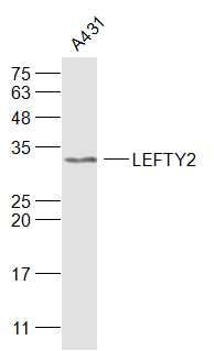 Lane 1: A431 cell lysates probed with TGFB4 Polyclonal Antibody, Unconjugated (bs-0061R) at 1:1000 dilution and 4˚C overnight incubation. Followed by conjugated secondary antibody incubation at 1:20000 for 60 min at 37˚C.