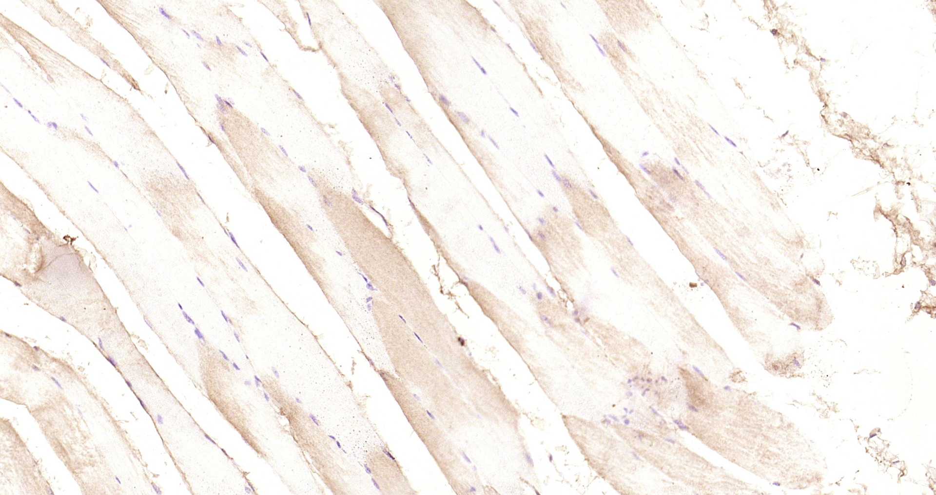 Paraformaldehyde-fixed, paraffin embedded Mouse muscle; Antigen retrieval by boiling in sodium citrate buffer (pH6.0) for 15min; Block endogenous peroxidase by 3% hydrogen peroxide for 20 minutes; Blocking buffer (normal goat serum) at 37°C for 30min; Antibody incubation with PI3 kinase p85 alpha subunit Polyclonal Antibody, Unconjugated (bs-0128R) at 1:200 overnight at 4°C, DAB staining.