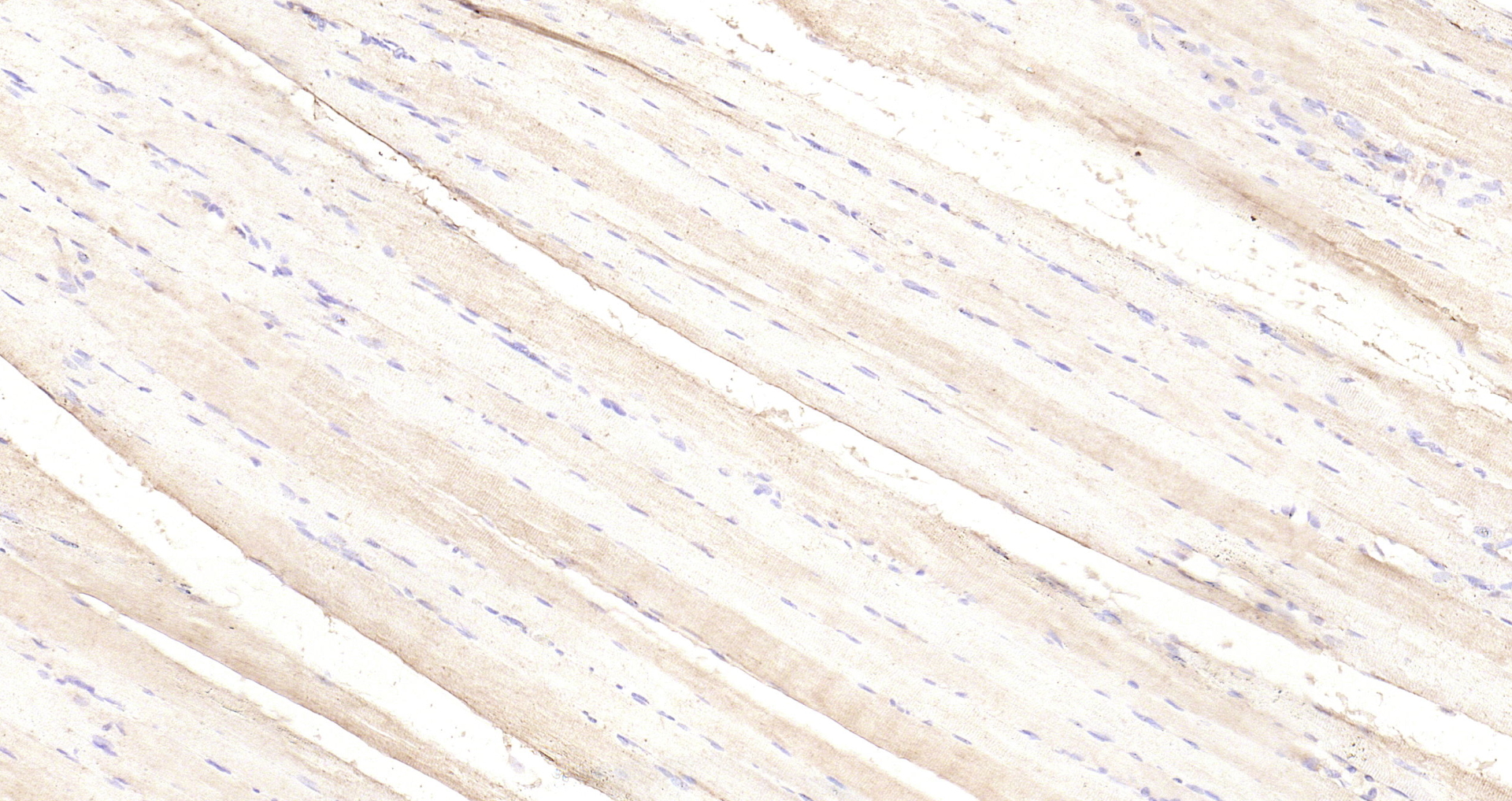 Paraformaldehyde-fixed, paraffin embedded Rat muscle; Antigen retrieval by boiling in sodium citrate buffer (pH6.0) for 15min; Block endogenous peroxidase by 3% hydrogen peroxide for 20 minutes; Blocking buffer (normal goat serum) at 37°C for 30min; Antibody incubation with PI3 kinase p85 alpha subunit Polyclonal Antibody, Unconjugated (bs-0128R) at 1:200 overnight at 4°C, DAB staining.