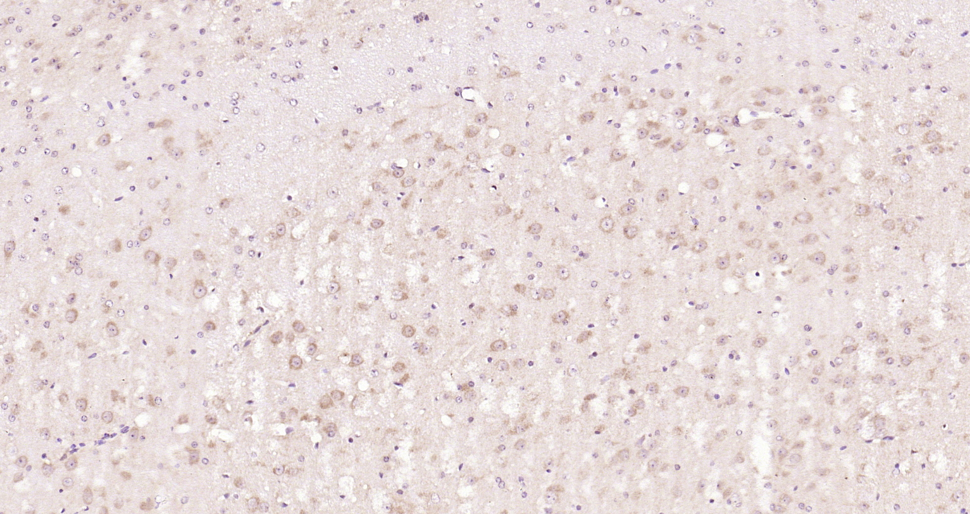 Paraformaldehyde-fixed, paraffin embedded Mouse brain; Antigen retrieval by boiling in sodium citrate buffer (pH6.0) for 15min; Block endogenous peroxidase by 3% hydrogen peroxide for 20 minutes; Blocking buffer (normal goat serum) at 37°C for 30min; Antibody incubation with Nrf2 Polyclonal Antibody, Unconjugated (bs-1074R) at 1:200 overnight at 4°C, DAB staining.