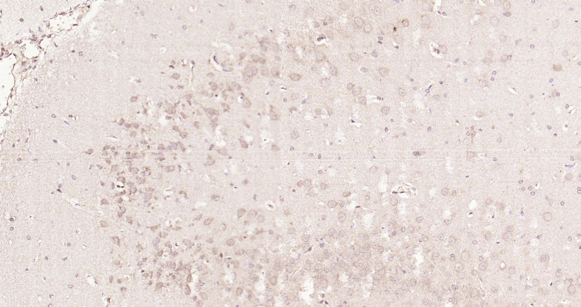 Paraformaldehyde-fixed, paraffin embedded Rat brain; Antigen retrieval by boiling in sodium citrate buffer (pH6.0) for 15min; Block endogenous peroxidase by 3% hydrogen peroxide for 20 minutes; Blocking buffer (normal goat serum) at 37°C for 30min; Antibody incubation with Nrf2 Polyclonal Antibody, Unconjugated (bs-1074R) at 1:200 overnight at 4°C, DAB staining.