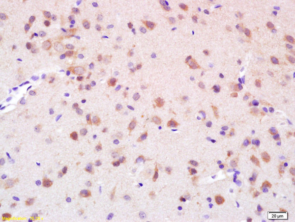 Formalin-fixed and paraffin embedded rat brain labeled with  Rabbit Anti phospho-EphB1\/Eph receptor B1(Tyr928) Antibody, Unconjugated (bs-10138R) at 1:200 followed by conjugation to the secondary antibody and DAB staining